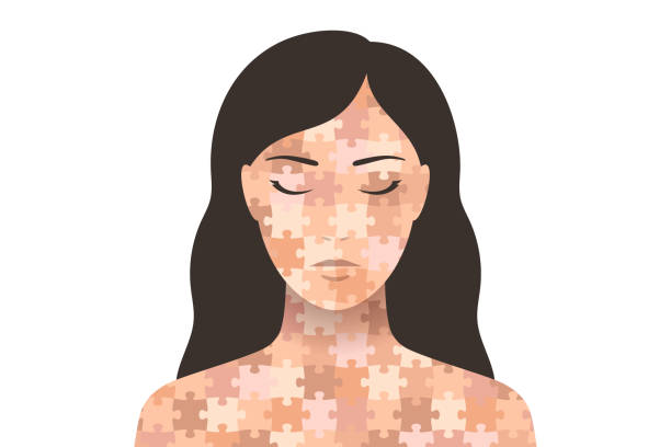 ilustraciones, imágenes clip art, dibujos animados e iconos de stock de mujer con piel clara ensamblada a partir de piezas de rompecabezas de diferentes tonos - dermatología