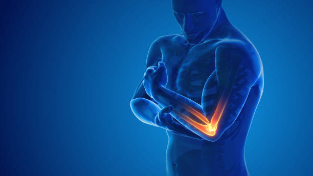 pain in the elbow joint - armbot fotos stockfoto's en -beelden