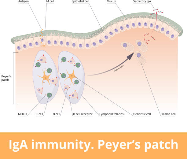 IgA immunity. Peyer’s patch Lymphoid follicles of the small intestine generate IgA immune response with B cells, T cells, dendritic cells, and plasma cells secreting IgA. epithelium stock illustrations