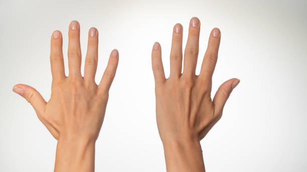 istock Women's hands count on fingers ten back of palms 1415757504