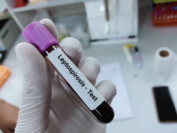 Biochemist of Scientist holds blood sample for Leptospirosis test. Biochemist of Scientist holds blood sample for Leptospirosis test. Medical test tube in laboratory background. leptospira stock pictures, royalty-free photos & images
