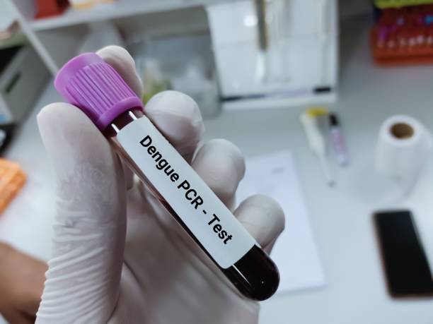 bioquímico de cientista segura amostra de sangue para teste pcr do vírus da dengue. - dengue - fotografias e filmes do acervo