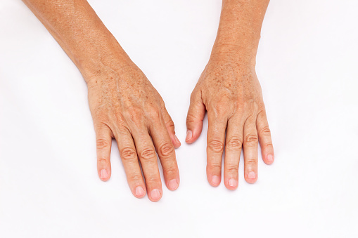 The hands of elderly woman with pigmented spots isolated on a white background. Age-related changes, flabby sagging skin, wrinkles and creases. Cosmetology and beauty concept