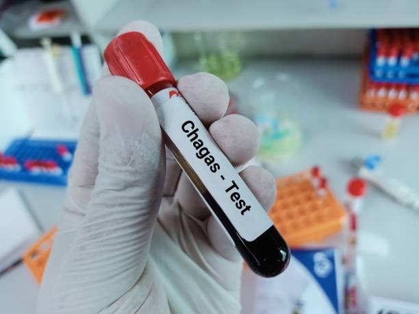 bioquímico de cientista segura amostra de sangue para teste de chagas. - doença de chagas - fotografias e filmes do acervo