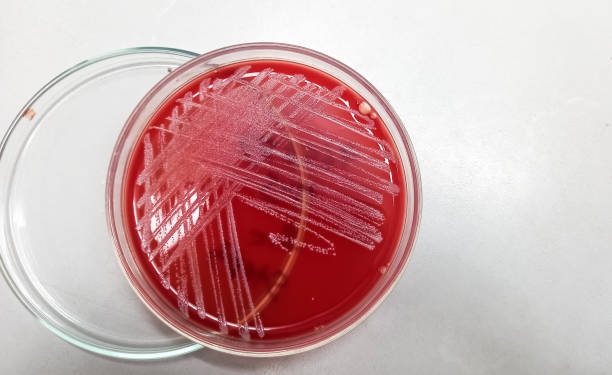 istock Blood agar medium growth of streptococcus, staphylococcus aureus, gram positive bacteria at medical microbiology laboratory. 1415976650