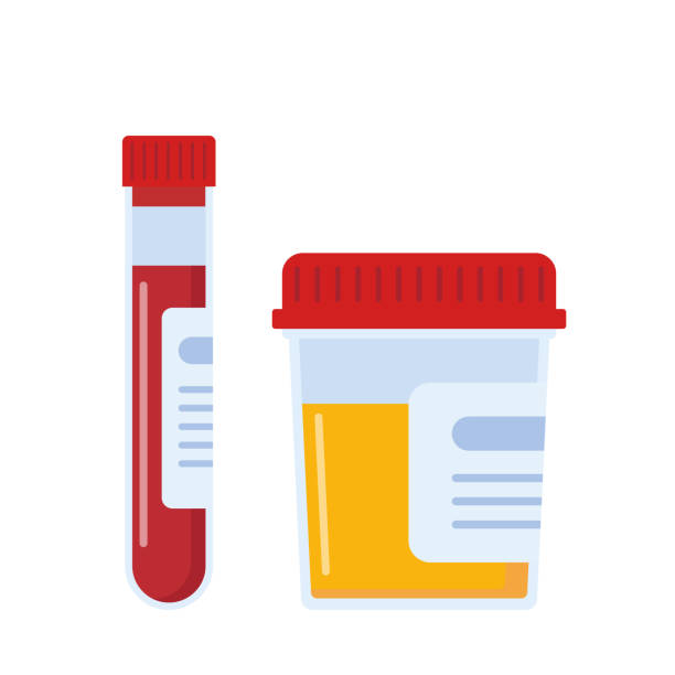 Laboratory samples of urine and blood. Medical sample in a glass tube. Laboratory container. Vector illustration. Laboratory samples of urine and blood. Medical sample in a glass tube. Laboratory container. Vector illustration medical research blood stock illustrations