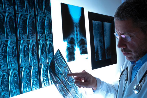 방사선 전문의 의사는 병원에서 방사선 촬영, x 선 및 자기 공명 영상 스캔으로 척추 기둥을 검사합니다. 건강 검진 및 진단. 건강 보험 개념. - human spine mri scan x ray doctor 뉴스 사진 이미지