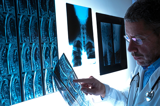 Radiologist doctor examining spinal column by radiography, x-ray and magnetic resonance imaging scan in hospital. Medical check-up and diagnosis. Health insurance concept.