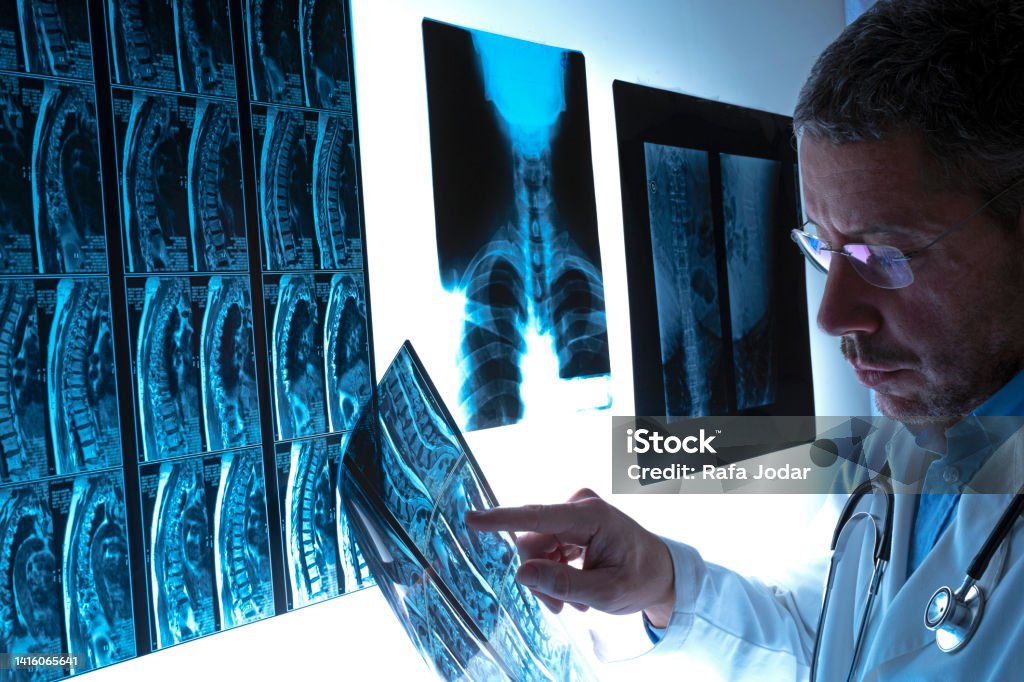 Radiologist doctor examining spinal column by radiography, x-ray and magnetic resonance imaging scan in hospital. Medical check-up and diagnosis. Health insurance concept. Spine - Body Part Stock Photo