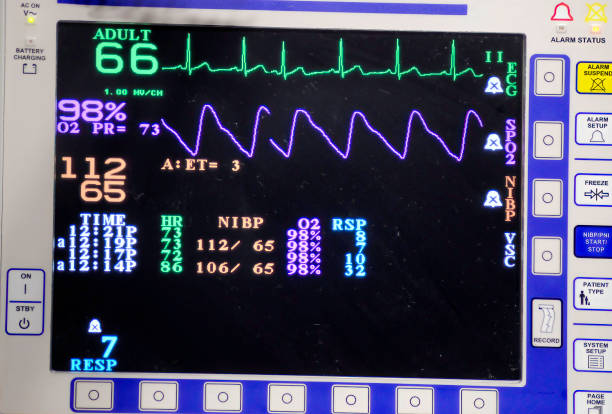 istock Hemodynamic Monitoring Using and Electrocardiogram During Anesthesia 1416589214