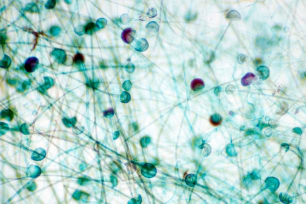 istock Mold sporangium slide 1417023632
