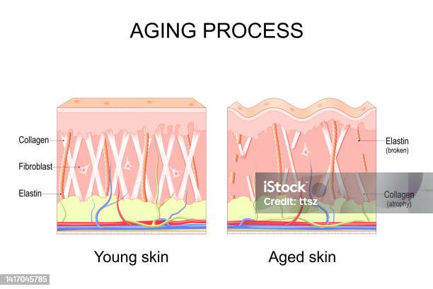 노화 과정 젊은 피부와 노인 피부의 비교 콜라겐 엘라스틴 및 섬유아세포 콜라겐에 대한 스톡 벡터 아트 및 기타 이미지 - 콜라겐 ...