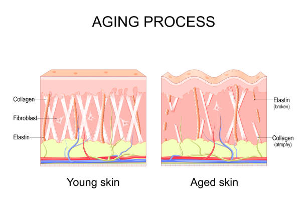 Aging process. comparison of Young and aged skin. Collagen, Elastin and fibroblasts vector art illustration