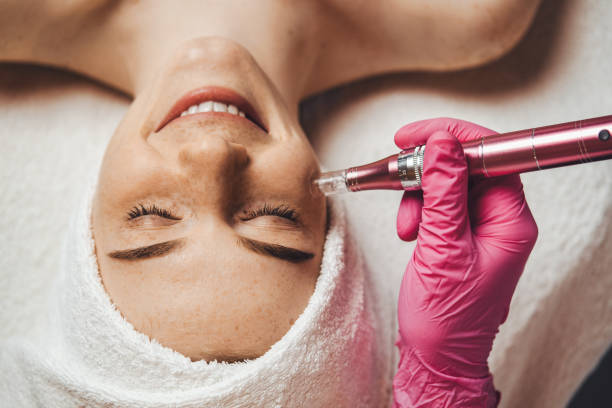 ritratto ravvicinato di donna che riceve un trattamento di peeling con idromicrodermoabrasione facciale presso la clinica termale. trattamento viso. viso di bellezza. bellezza della pelle. cosmetologia estetica, cura del viso - microdermabrasion foto e immagini stock