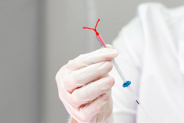 Gynecologist holding an IUD birth control device stock photo