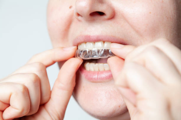 istock Caps for teeth after braces hold bite in desired position 1417600970