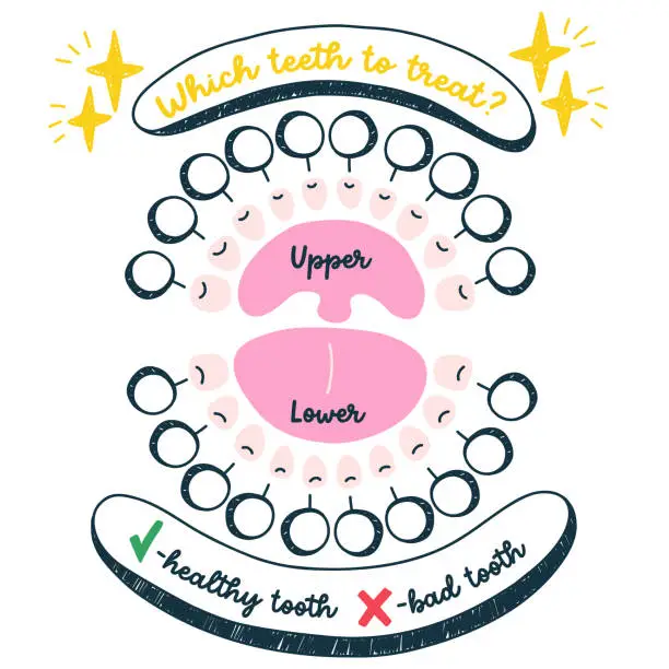 Vector illustration of Infographics of children dental treatment