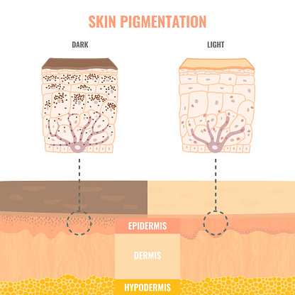 Comparison of melanosomes distribution in dark and light skin.  Pigmentation mechanism in different skin phototypes infographics. Close up of epidermis cross-section. Vector medical illustration.