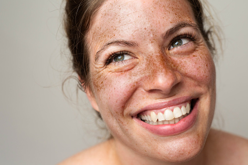 Beauty is in everyone.\nClose-up portrait of a woman with freckles
