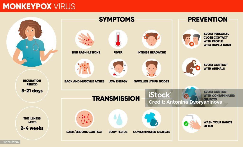 Key Pox Monkeypox Virus Symptoms Simple Infographic Post Stock Illustration ...