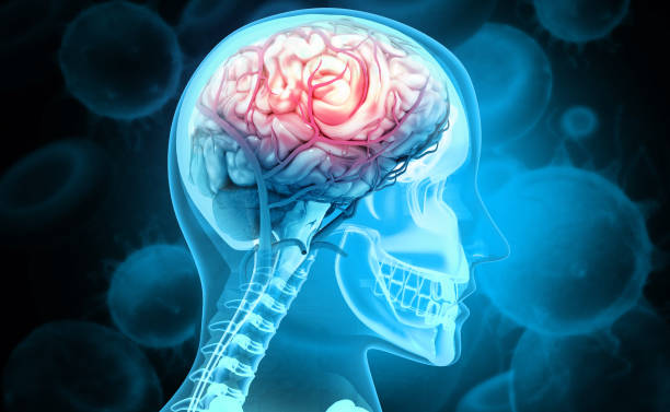 human brain injury,damage,hemorrhage. 3d illustration - inflammation imagens e fotografias de stock