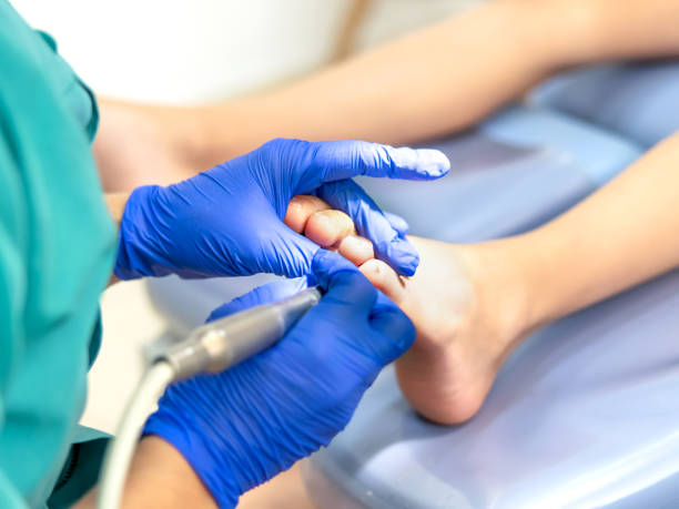 istock Close-up of a podiatry treatment. Selective focus 1417988545