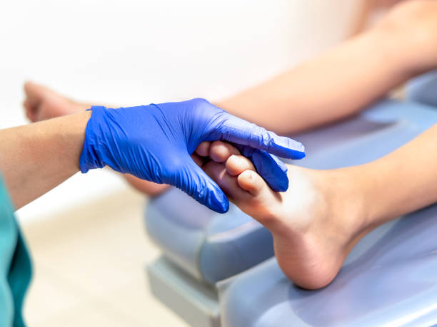 podóloga que examina paciente com tratamento de quiropodia. foco seletivo - podiatry chiropody women pedicure - fotografias e filmes do acervo