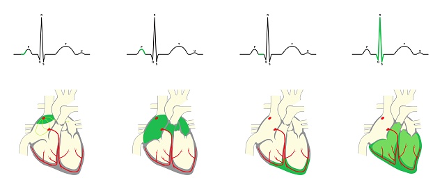 Heart Rythom Eeg Normal Heart Rhythm Electrocardiogram Corresponding To The Sequence Of ...