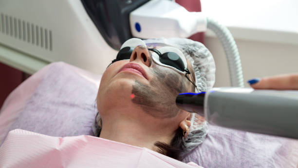istock Spa salon client woman on carbon laser peeling procedure 1418186594