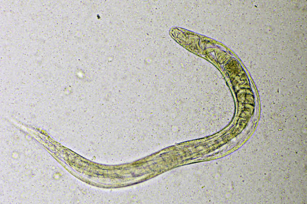 istock Strongyloides stercoralis in human stool 1418203209