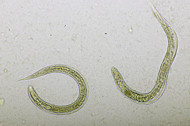 istock Strongyloides stercoralis in human stool 1418203212