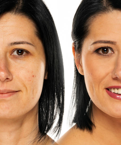 istock Comparison portrait of a woman without and with makeup 1418240749