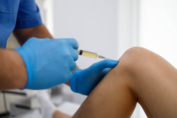 léčba bolesti kolene s plazmovou injekcí bohatou na krevní destičky. léčba artritidy a osteoartrózy - injekce aktivita - stock snímky, obrázky a fotky