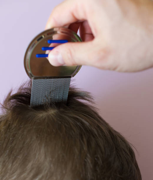 istock Lice comb and brunette hair copyspace 1418515818