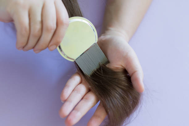 istock Lice comb and brunette hair 1418515829