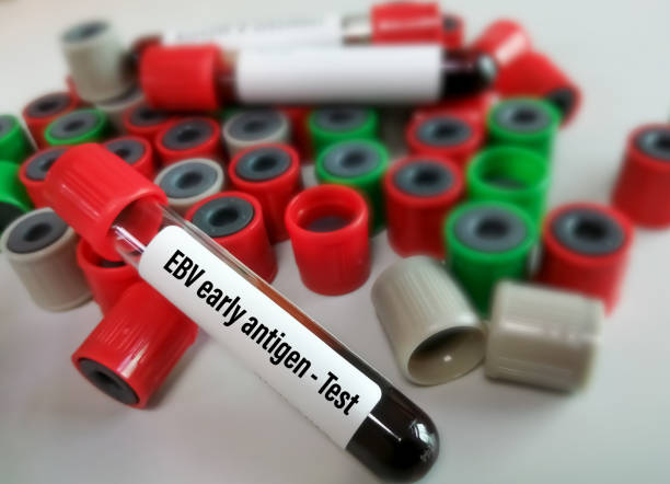 Blood sample isolated for EBV early antigen test. Blood sample isolated for EBV early antigen test. epstein barr virus photos stock pictures, royalty-free photos & images