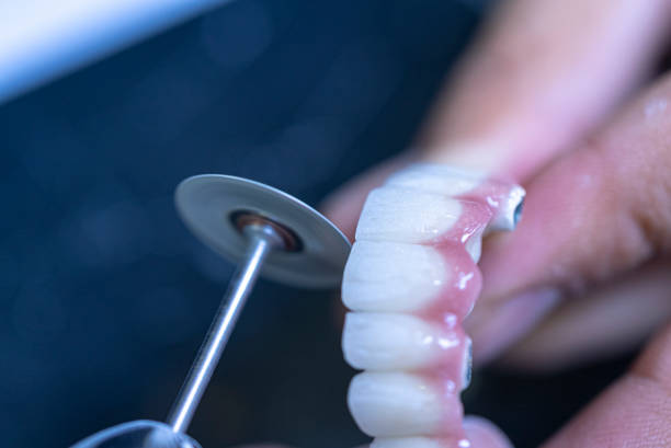 l'odontotecnico sta facendo denti protesici. - laboratory dentures dental hygiene human teeth foto e immagini stock