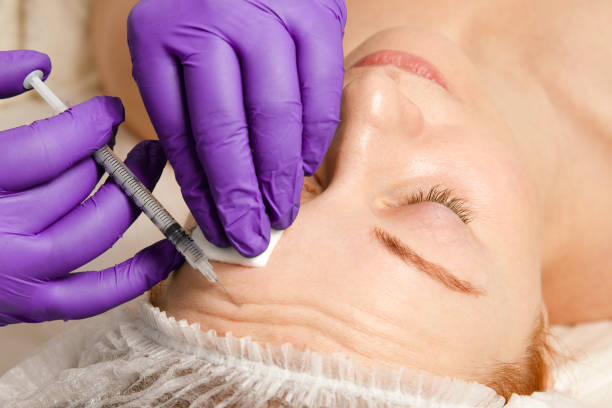 a cosmetologist performs a procedure of rejuvenating injections for the face to tighten and smooth out wrinkles on the skin of a woman's face. cosmetic skin care in a beauty salon. - medicine cabinet medicine healthcare and medicine cabinet imagens e fotografias de stock