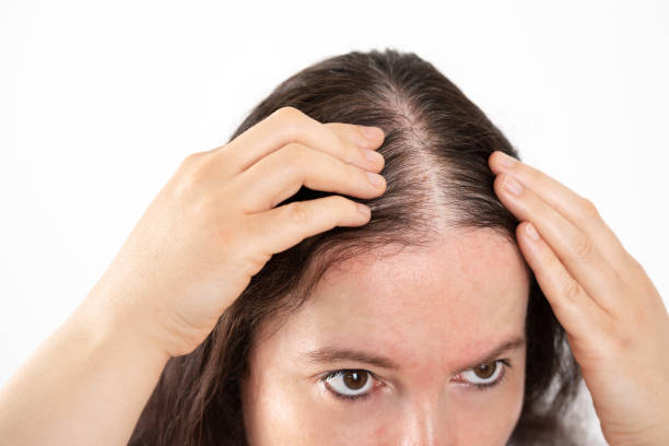 istock woman controls hair loss 1418809383