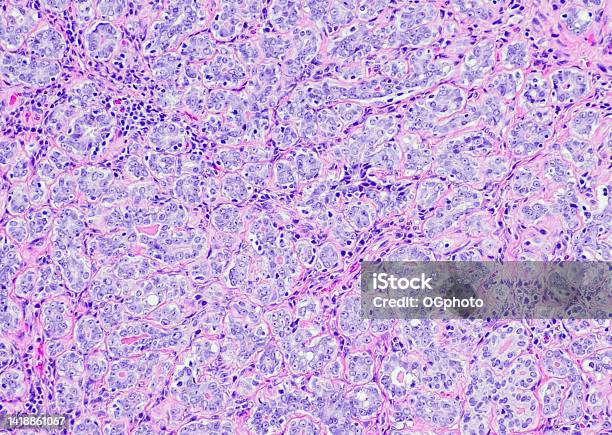 Tubular Adenoma Stock Photo - Download Image Now - Anatomy, Backgrounds, Biological Cell