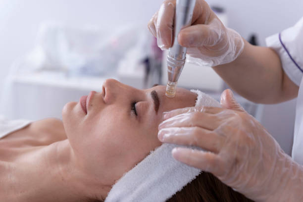 primer plano de cosmetólogo, esteticista que aplica tratamiento de dermapen facial en la cara de una joven cliente en el salón de belleza. cosmetología y cuidado profesional de la piel, rejuvenecimiento facial. - cuidado corporal y belleza fotografías e imágenes de stock