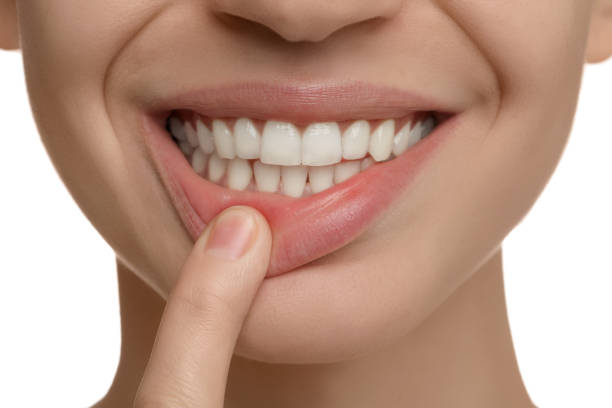 istock Woman with healthy teeth on white background, closeup 1419092569