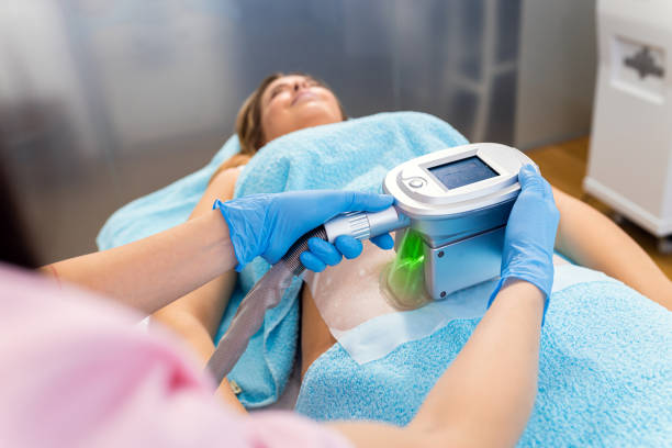 Beautician therapist applying cryolipolysis treatment in beauty salon. stock photo