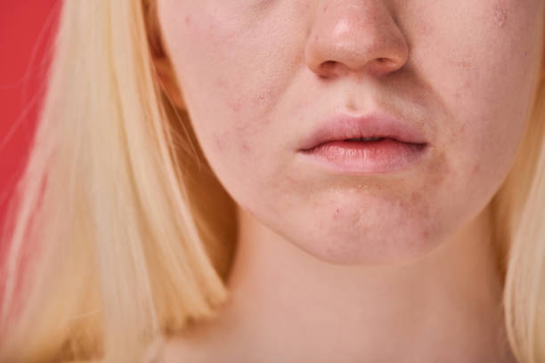 istock Female face with clean skin 1419252444