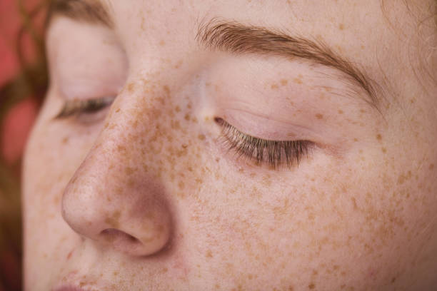 istock Young female face with freckles 1419252500