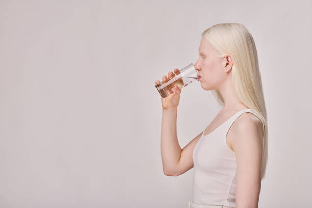 istock Albino young girl drinking water 1419252609