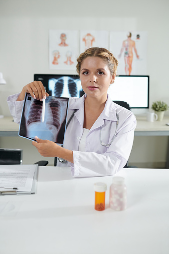 Portrait of young female general practitioner showing lungs x-ray of recovered patient