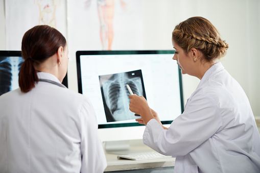 Medical workers analyzing lungs x-rays of patient with coronavirus