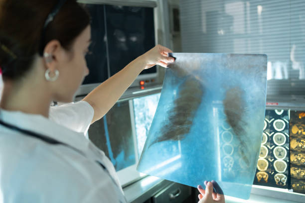 medico di radiologia femminile che esamina la pellicola a raggi x del torace del paziente nel laboratorio medico sanitario in ospedale - human lung x ray image x ray human spine foto e immagini stock