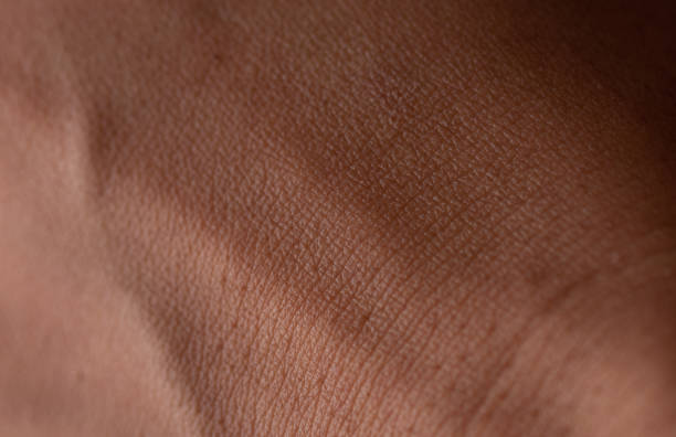istock Human skin texture background,brown skin 1419500281